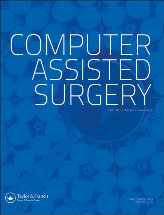 Cover image of Computer Assisted Surgery